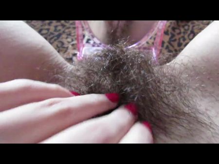 viana hairy